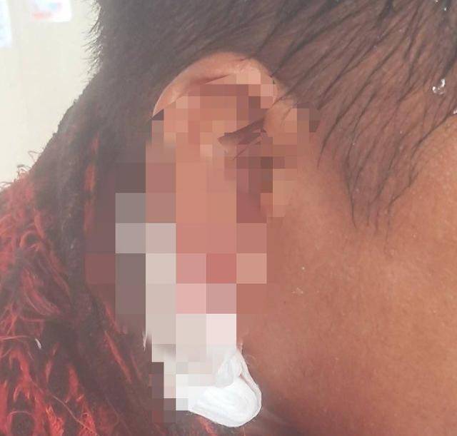 黄岩岛交锋,中方这次没客气:菲船员耳朵被崩伤,高举白旗求饶